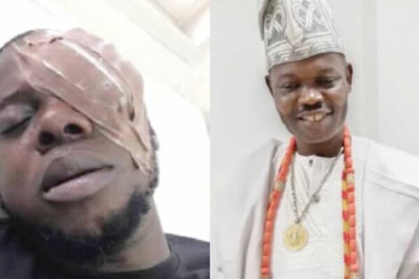 Nigerian Traditional ruler allegedly blinds trader for dancing with his queen, man cries out