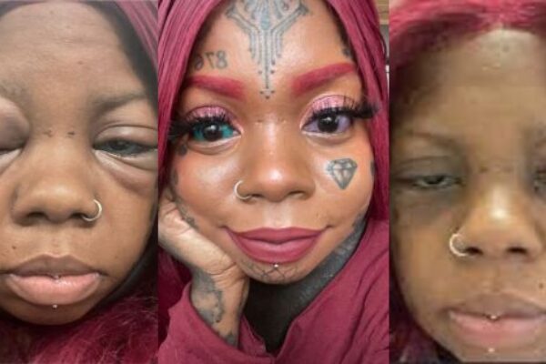 Mum-of-five facing permanent blindness after tattooing her eyeballs